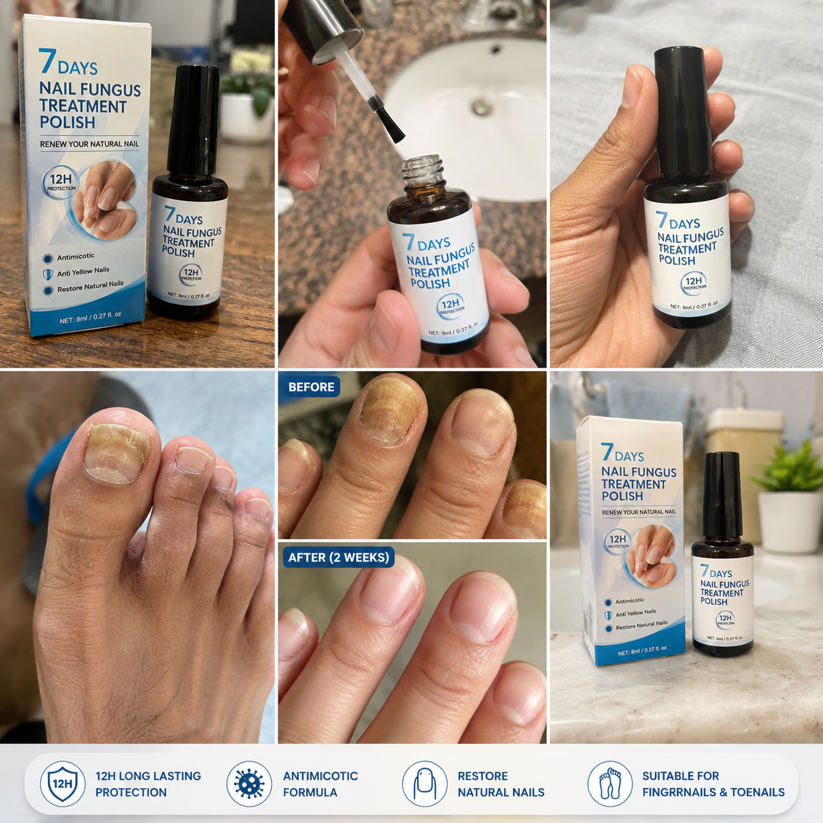 💅 7 Days Nail Fungus Treatment Polish