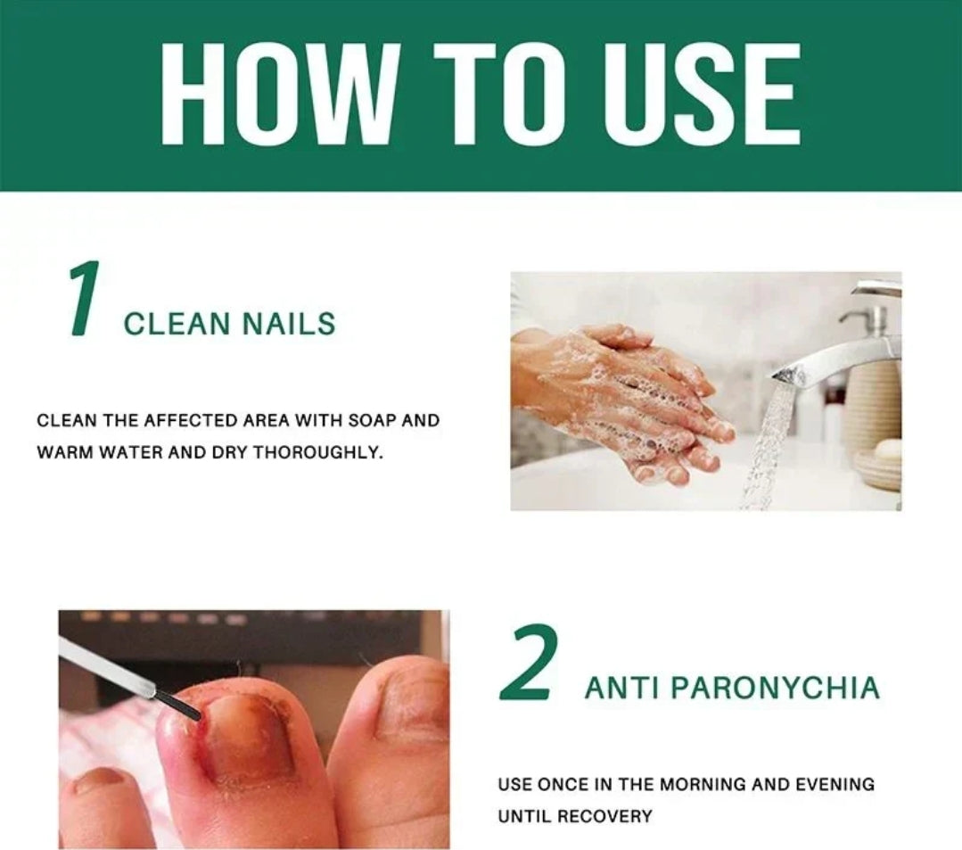 Anti Paronychia Relief Oil – Buy 1 Get 1 Free 🌿💅